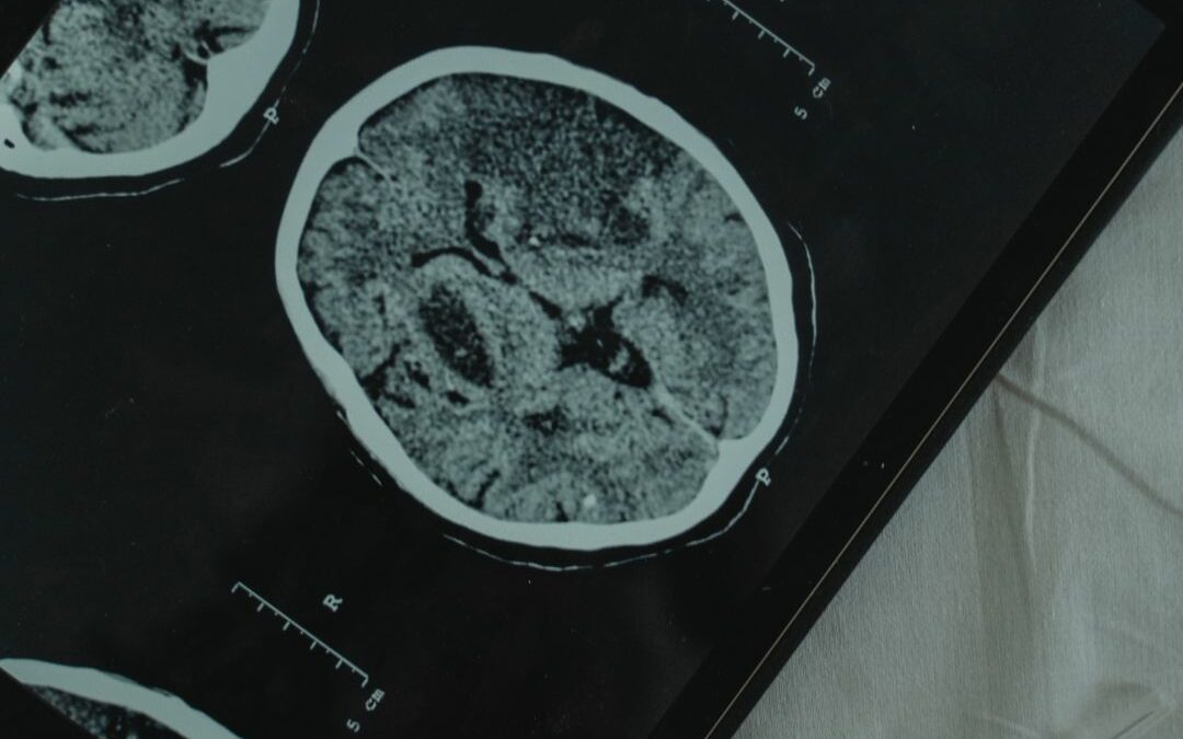 VISITA NEUROLOGICA