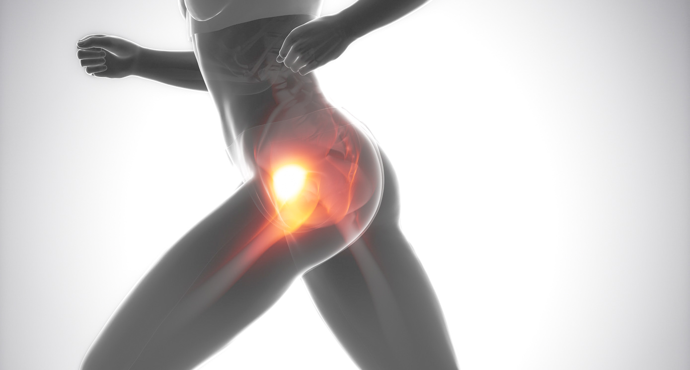 Trattamento specialistico per dolore alla testa del femore e lesione all'anca presso FisioSalus: riabilitazione efficace per il recupero completo