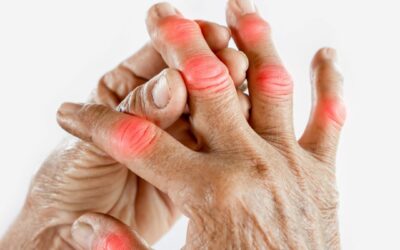 Esercizi per Artrosi Mani: Migliora Mobilità e Riduci il Dolore
