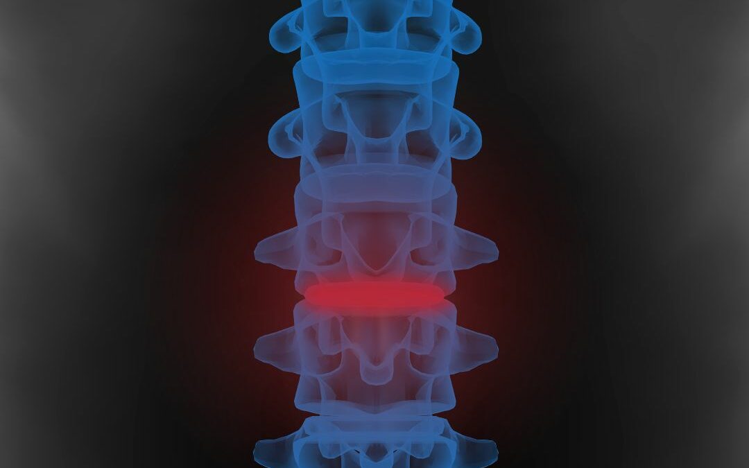 Vertebre Lombari: Anatomia, Funzioni e Prevenzione dei Dolori