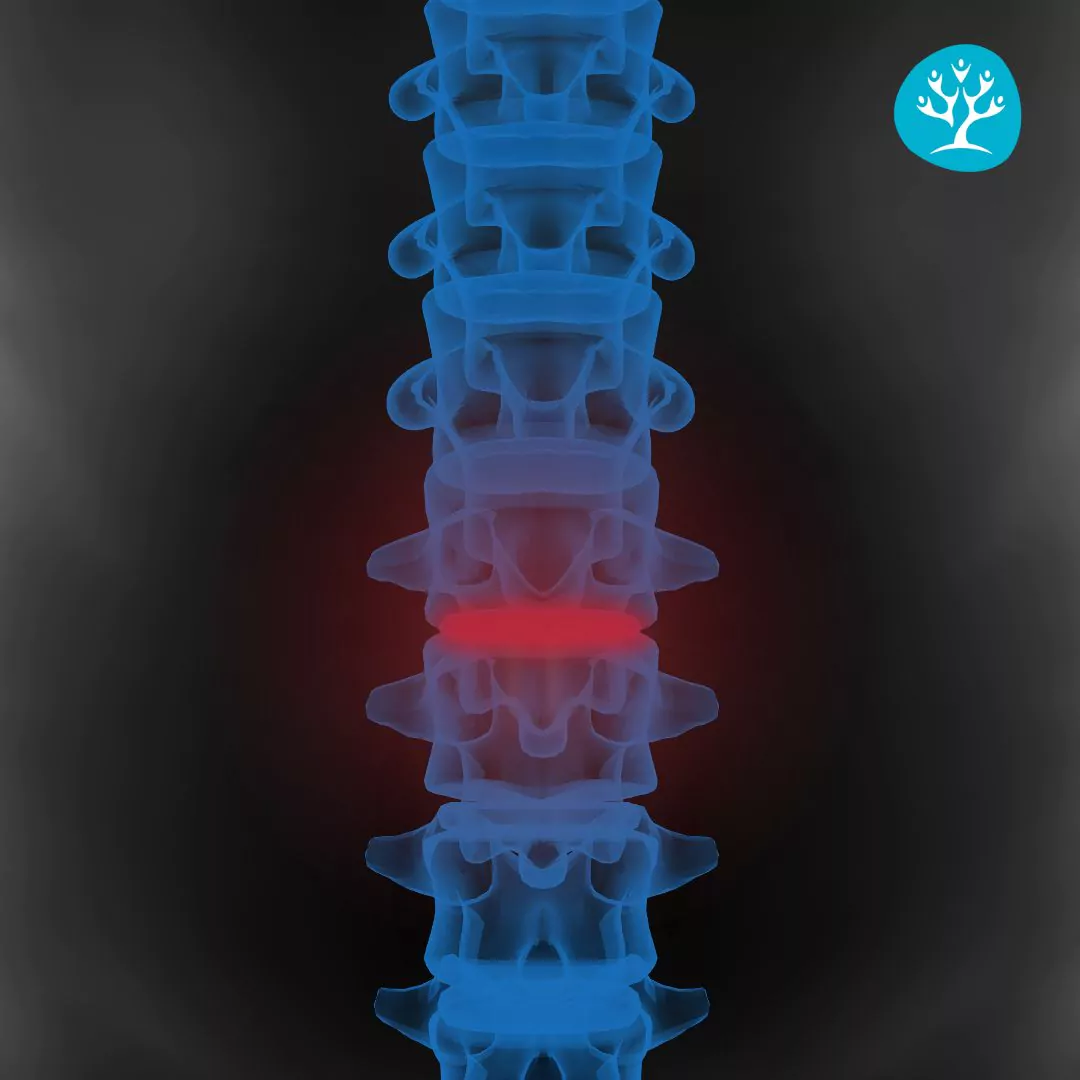 Vertebre Lombari: Anatomia, Funzioni e Prevenzione dei Dolori