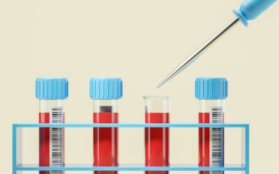 Check-Up Perugia: La Guida Definitiva alla Prevenzione