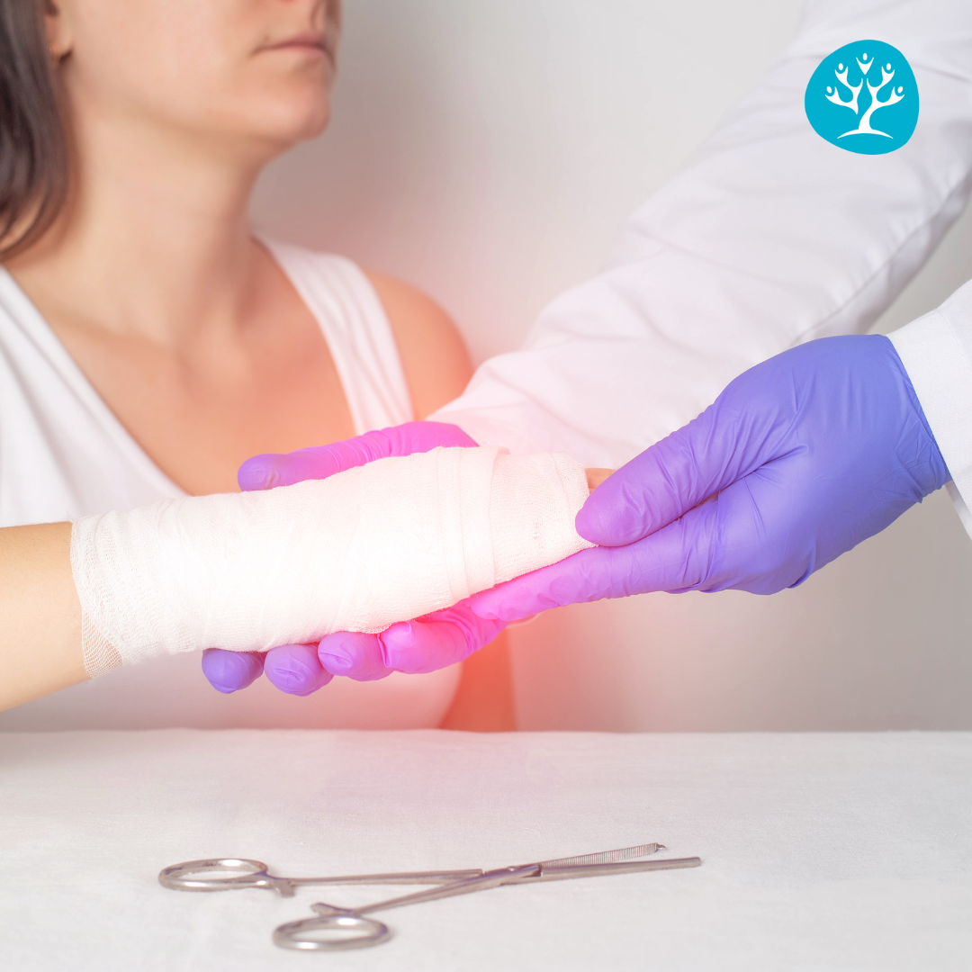 Fisioterapia dello scafoide: frattura evidente nella zona centrale.