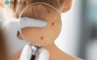 Dermatologo a Perugia: Visite Specialistiche Senza Attesa e Controllo Nei Completo