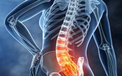 Perché mi fa male la schiena quando mi alzo la mattina? (Le 5 Cause Principali)