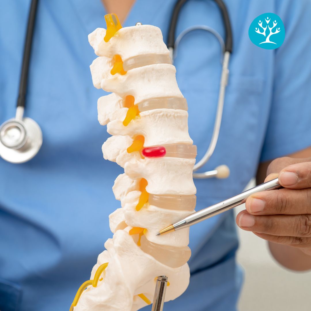 Trattamento per sciatalgia a Perugia presso il centro medico specializzato.