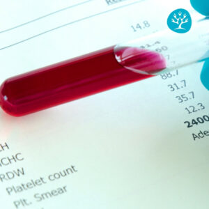 Prelievo del sangue al Centro Fisiosalus di Ponte Felcino Perugia