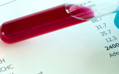 Dove fare le analisi del sangue a Perugia