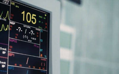 Elettrocardiogramma a Perugia